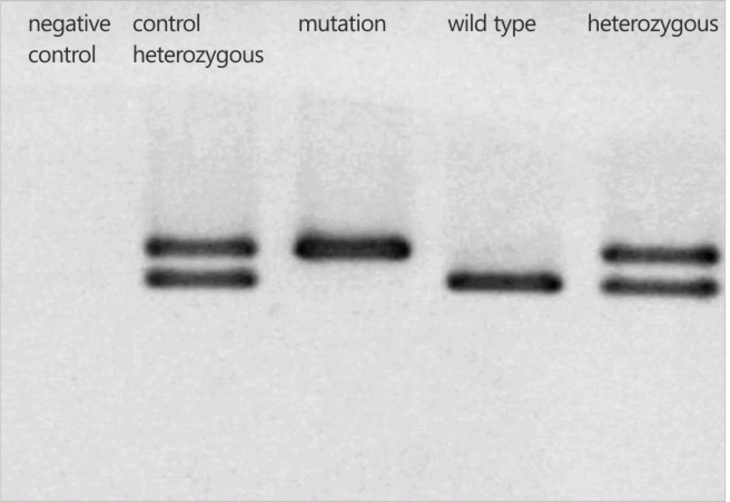 evaluation by gel electrophoresis