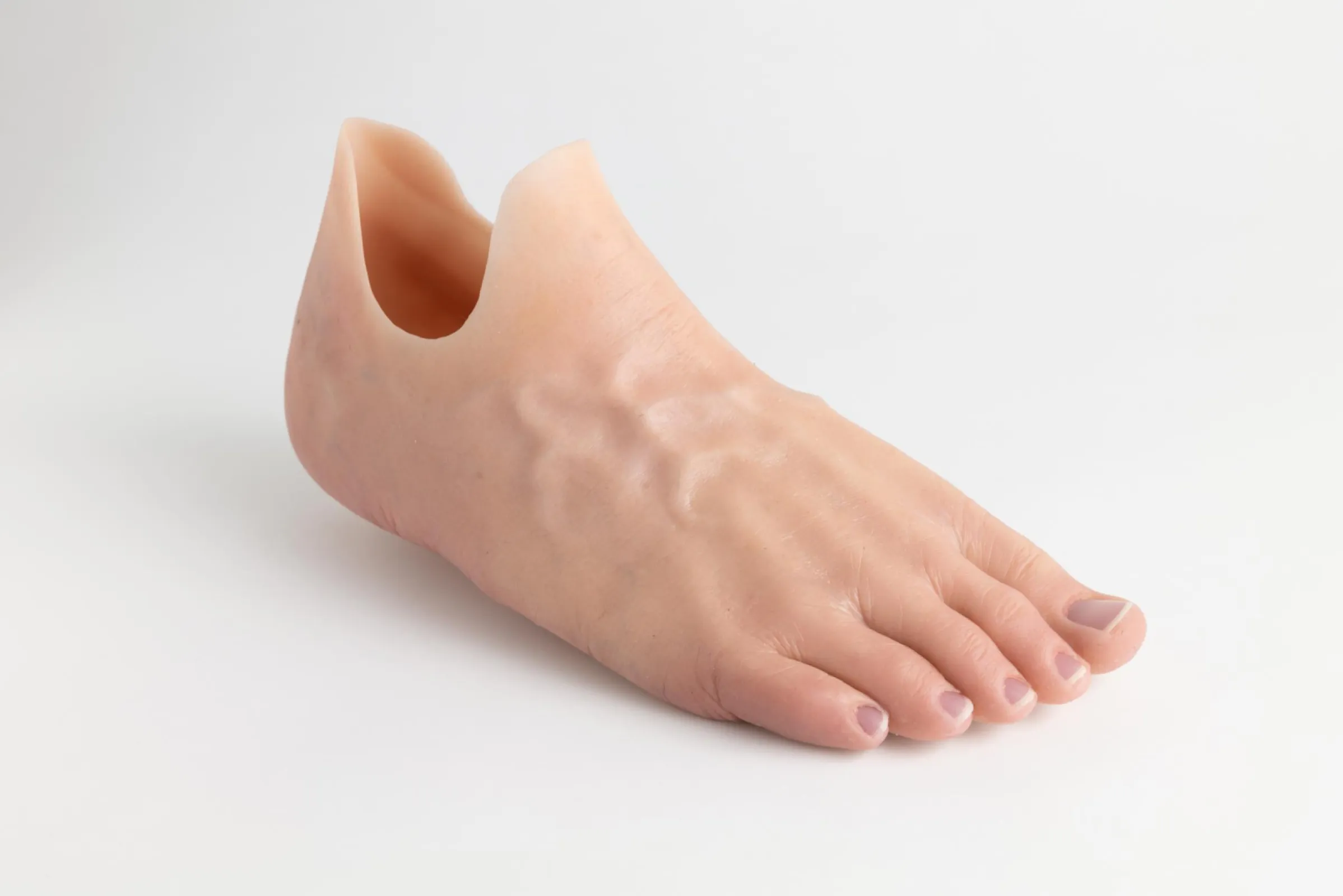partial foot prosthesis