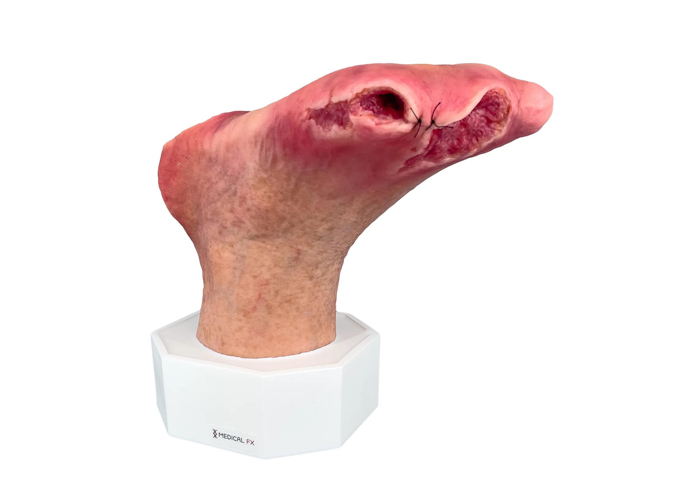 Base Model Diabetic Foot Syndrome with 7 Wounds