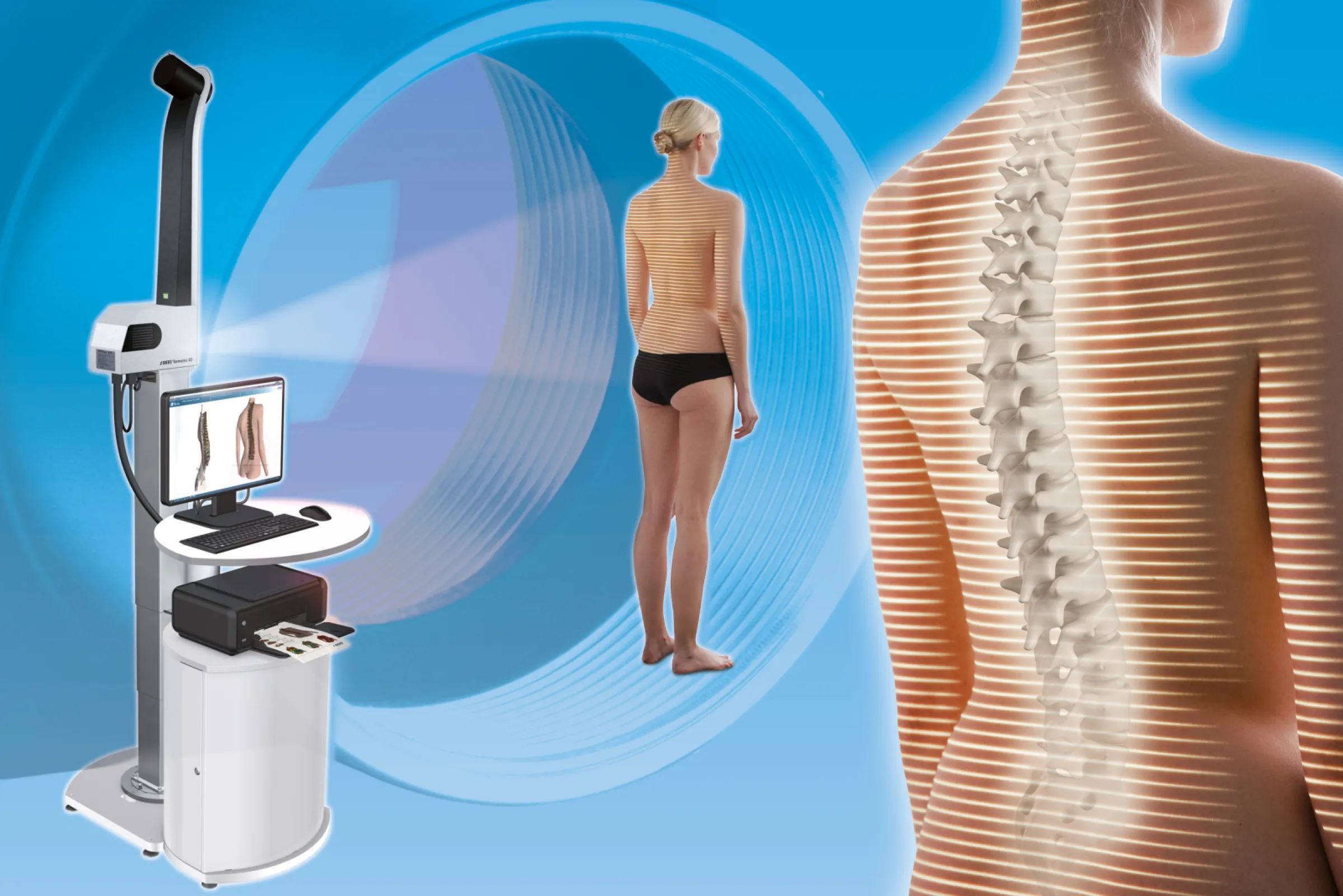 Optical spine and posture analysis with uEye CP industrial cameras.