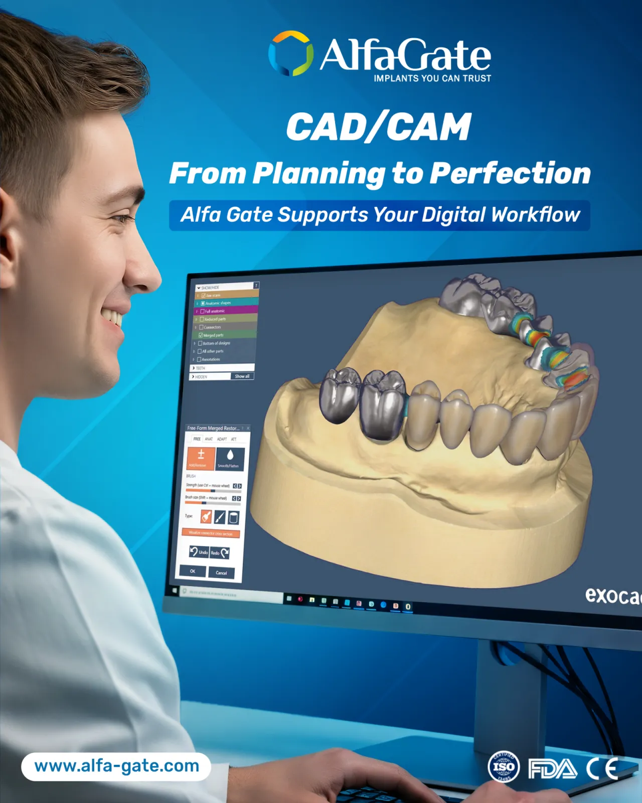 CAD/CAM