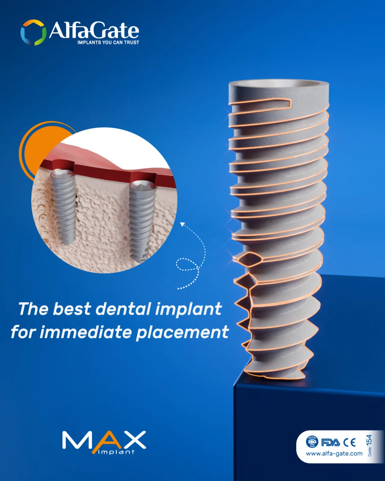 Max Implant