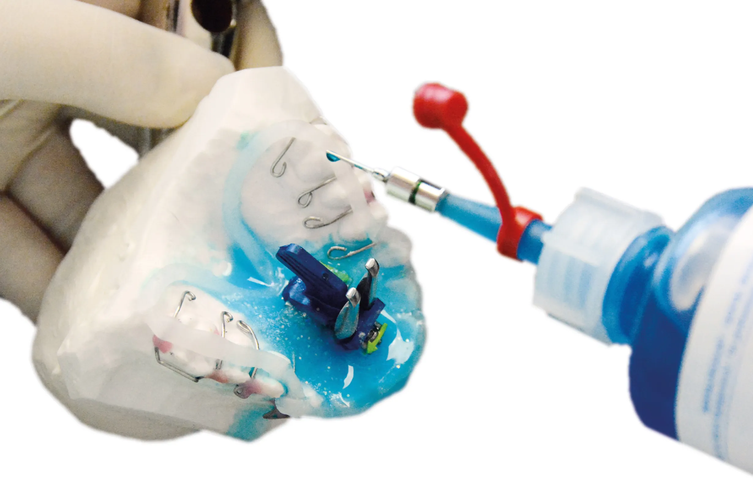 The use of Orthocryl® liquid, turquoise