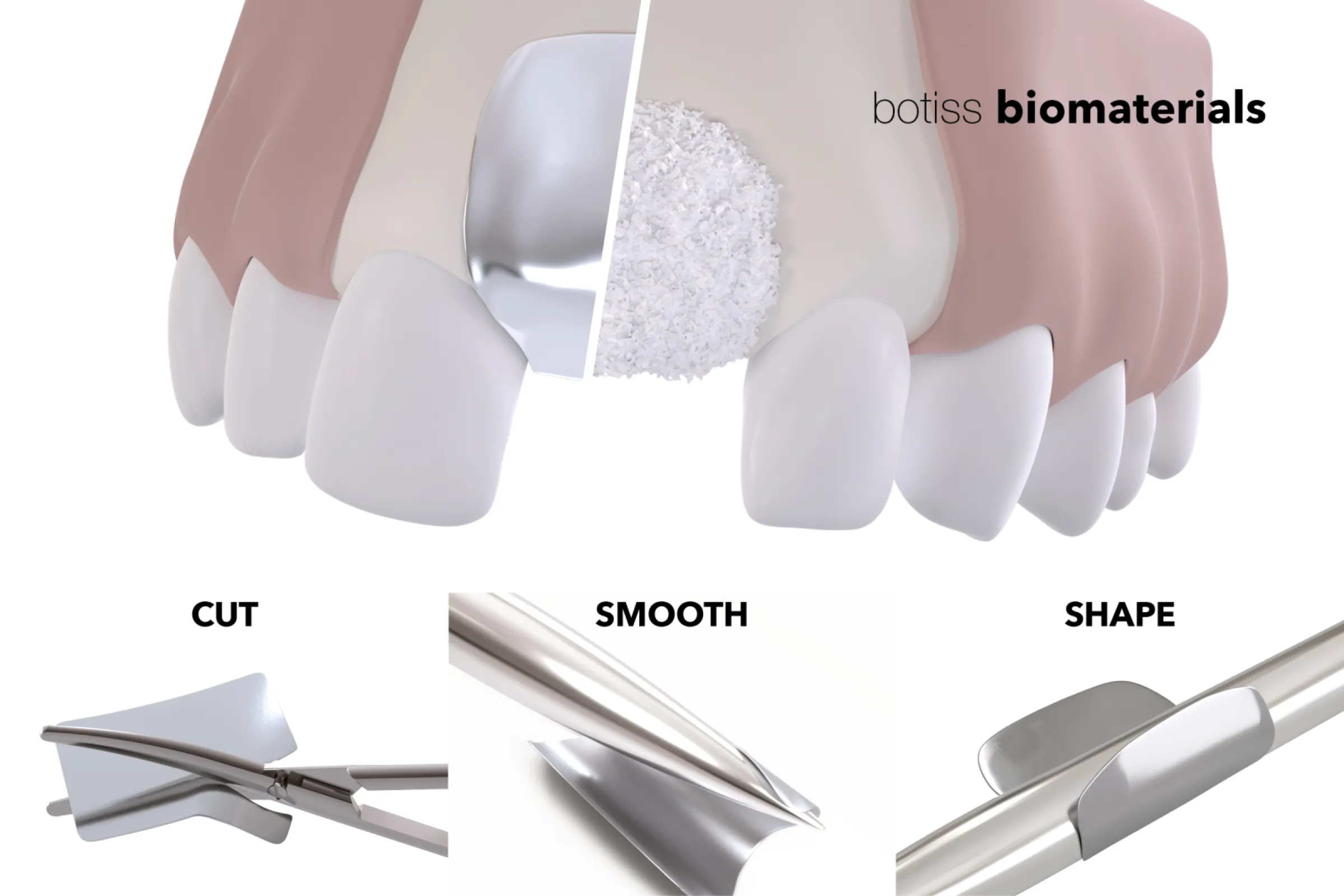NOVAMag® membrane can be trimmed to size and shaped for treating individual bone defects