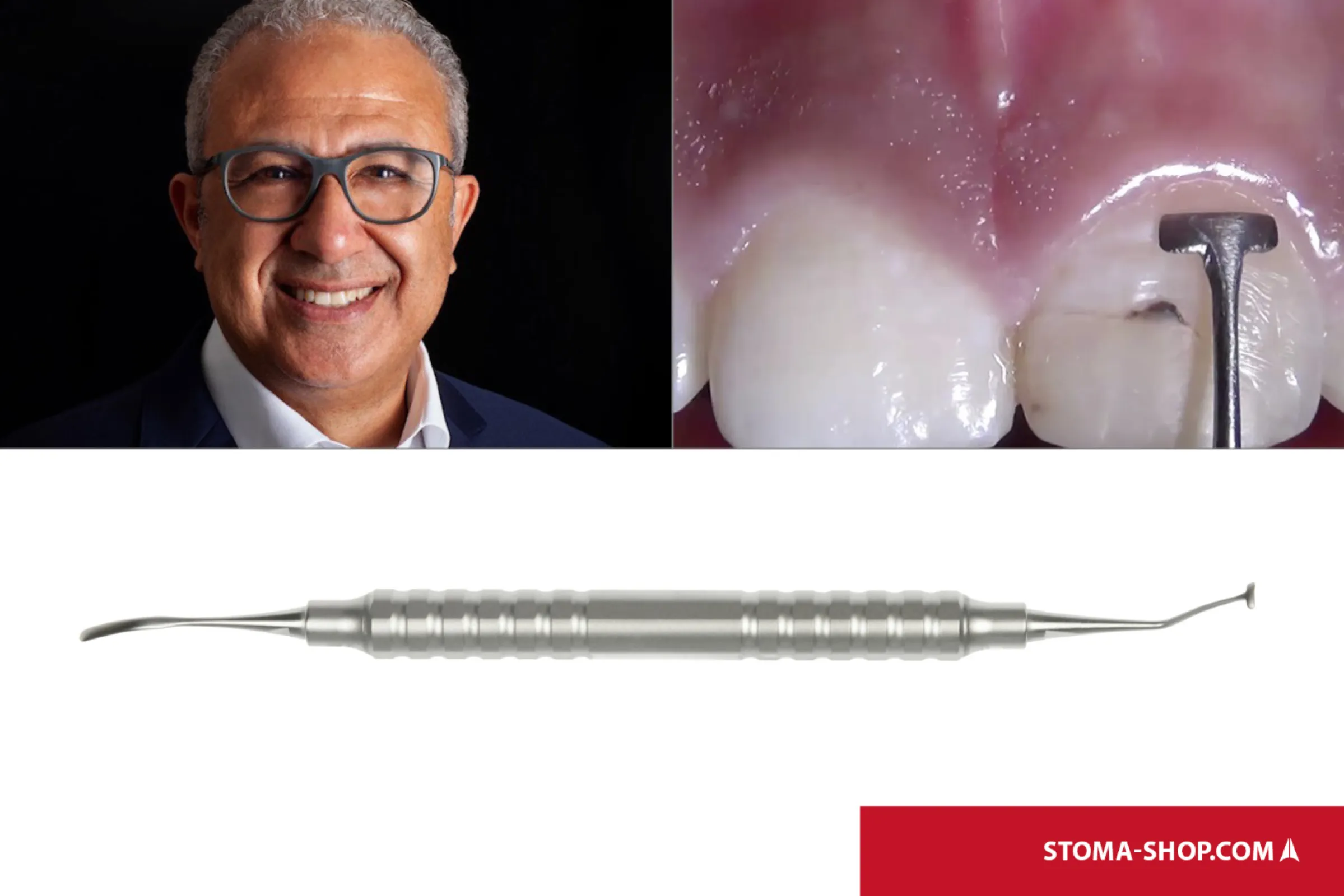 T-Tome in hammer form acc. to Dr. Abdelsalam Elaskary