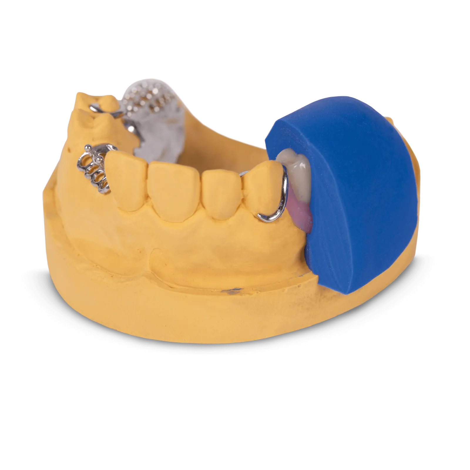 Silicone key made with gammasil PERFECT tec touch