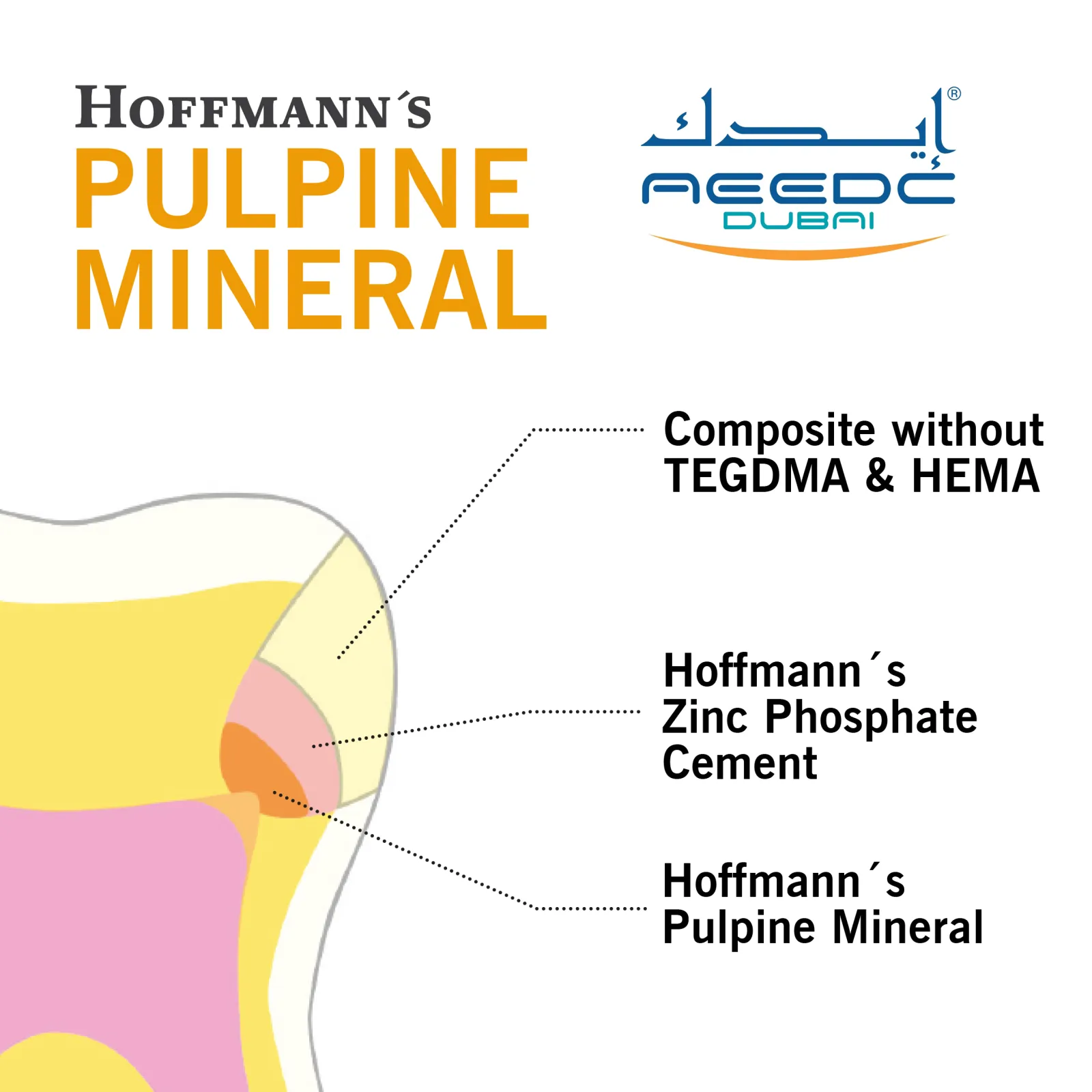 Treating deep carious lesions - 3 layers of materials (sandwich technique) starting with Hoffmann's Pulpine to protect the vital pulp