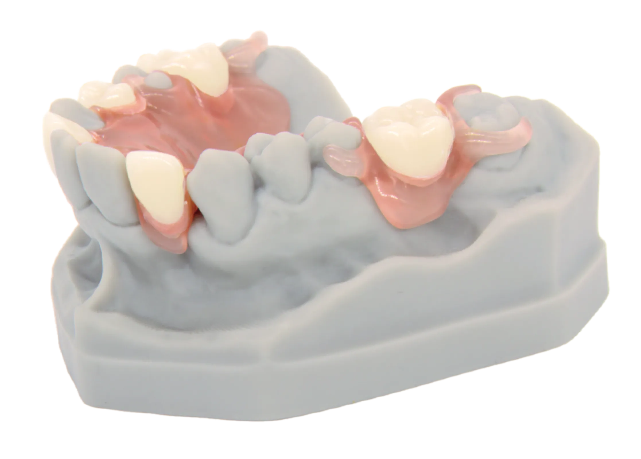 optimill memopink / dentona vivapnk