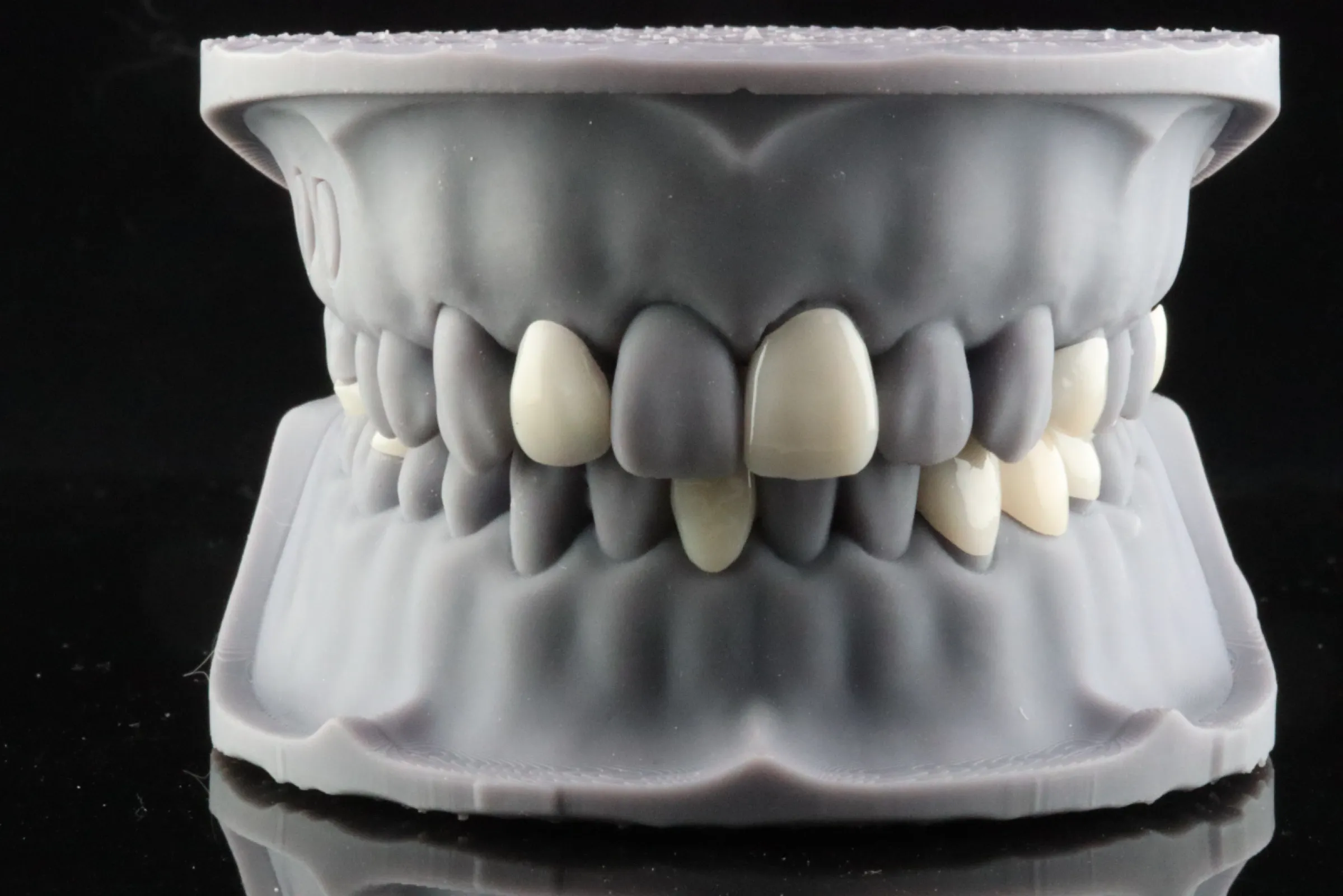 3Delta Crown - picture by Dr Andrew Ip