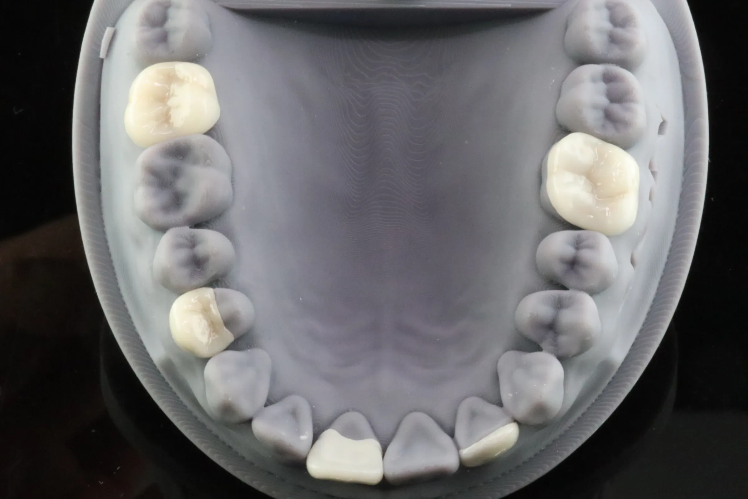 3Delta Crown - picture by Dr Andrew Ip