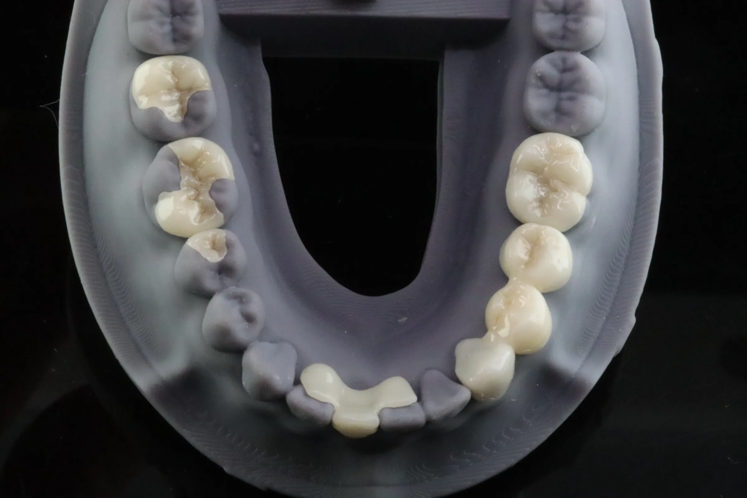 3Delta Crown - picture by Dr Andrew Ip