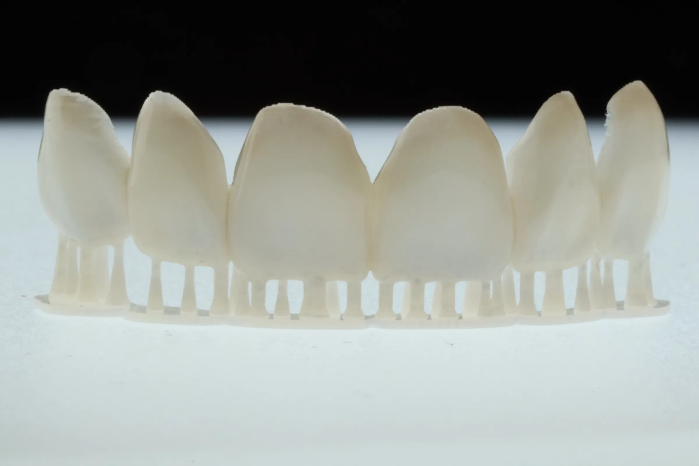 3Delta Crown - picture by Dr Andrew Ip