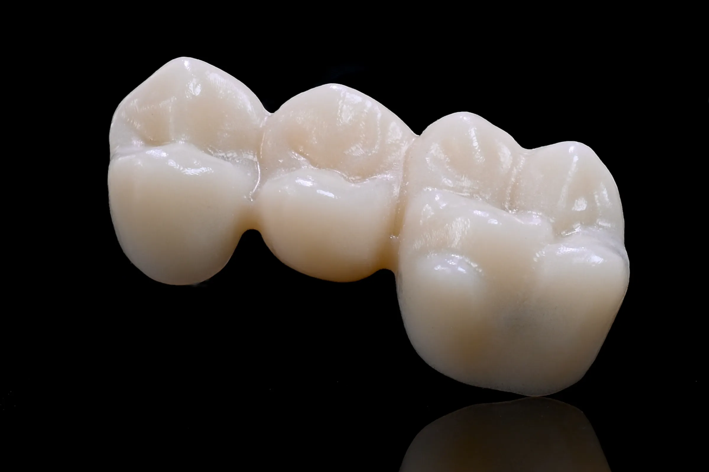 view of a CORiTEC PMMA Monolayer restauration