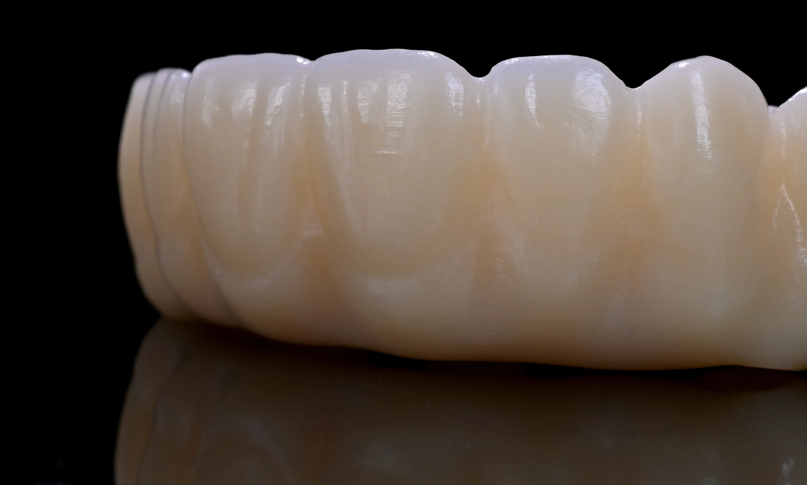 view of a CORiTEC PMMA Multilayer restauration