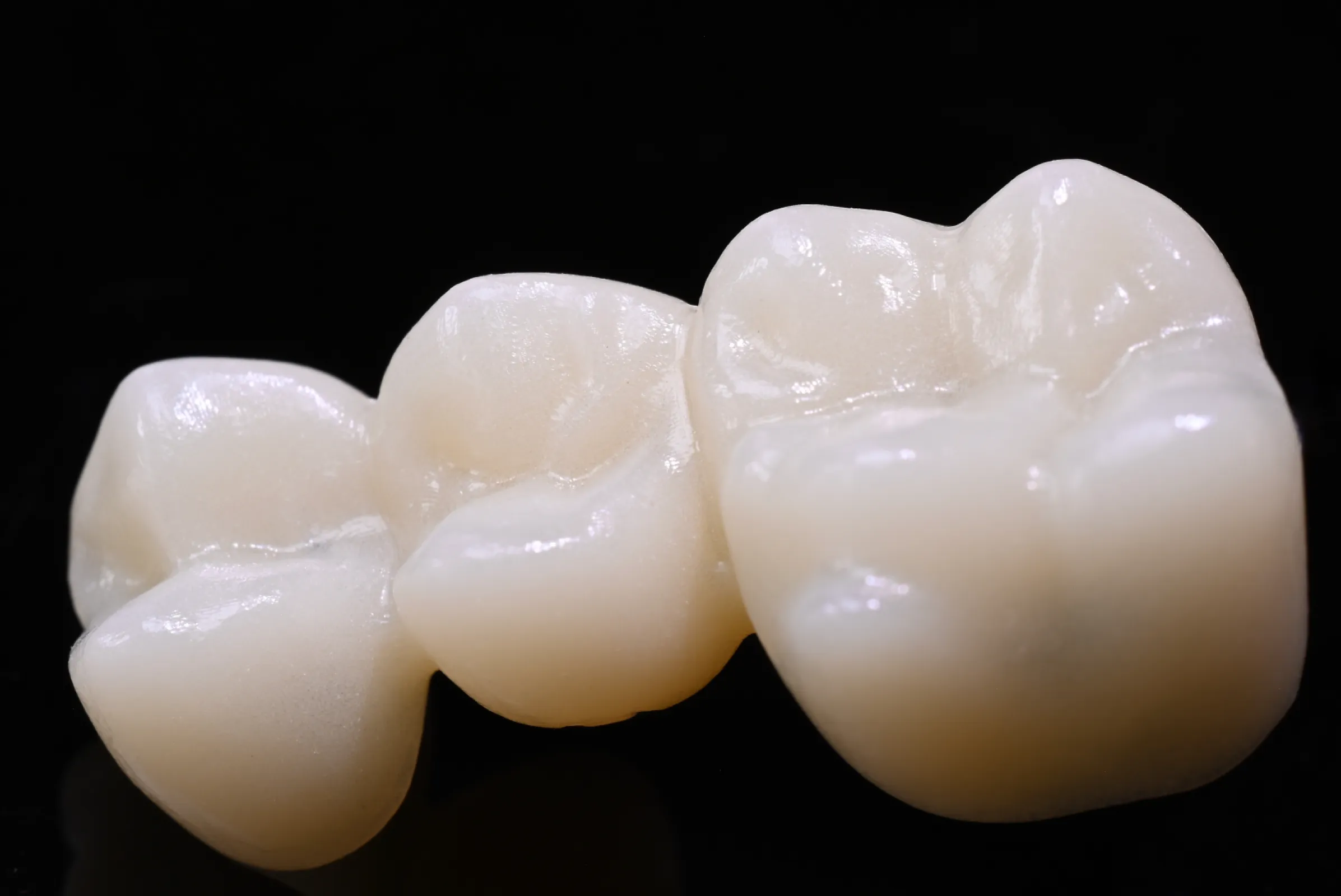 view of a CORiTEC PMMA Multilayer restauration