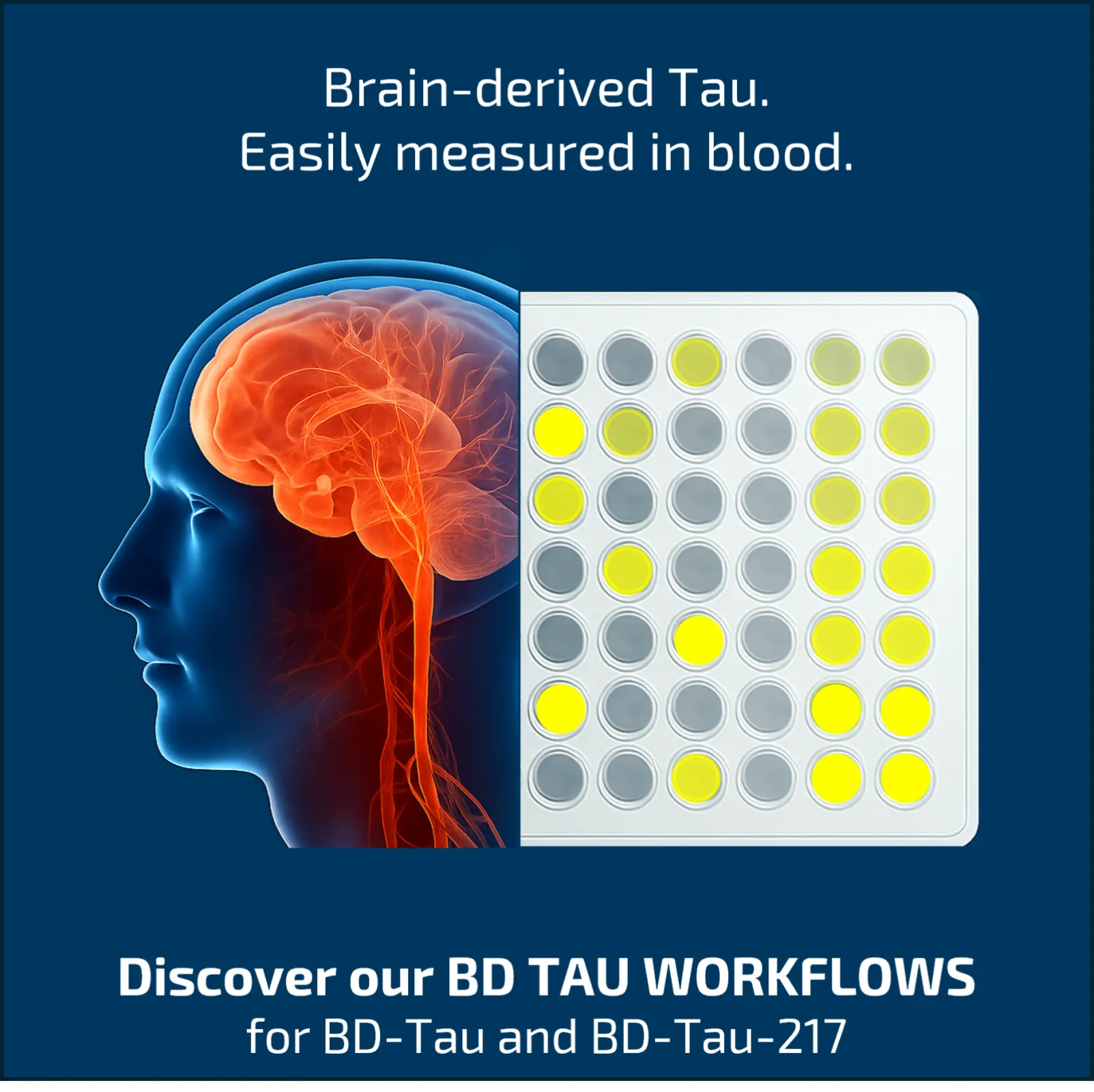 BD Tau Workflows