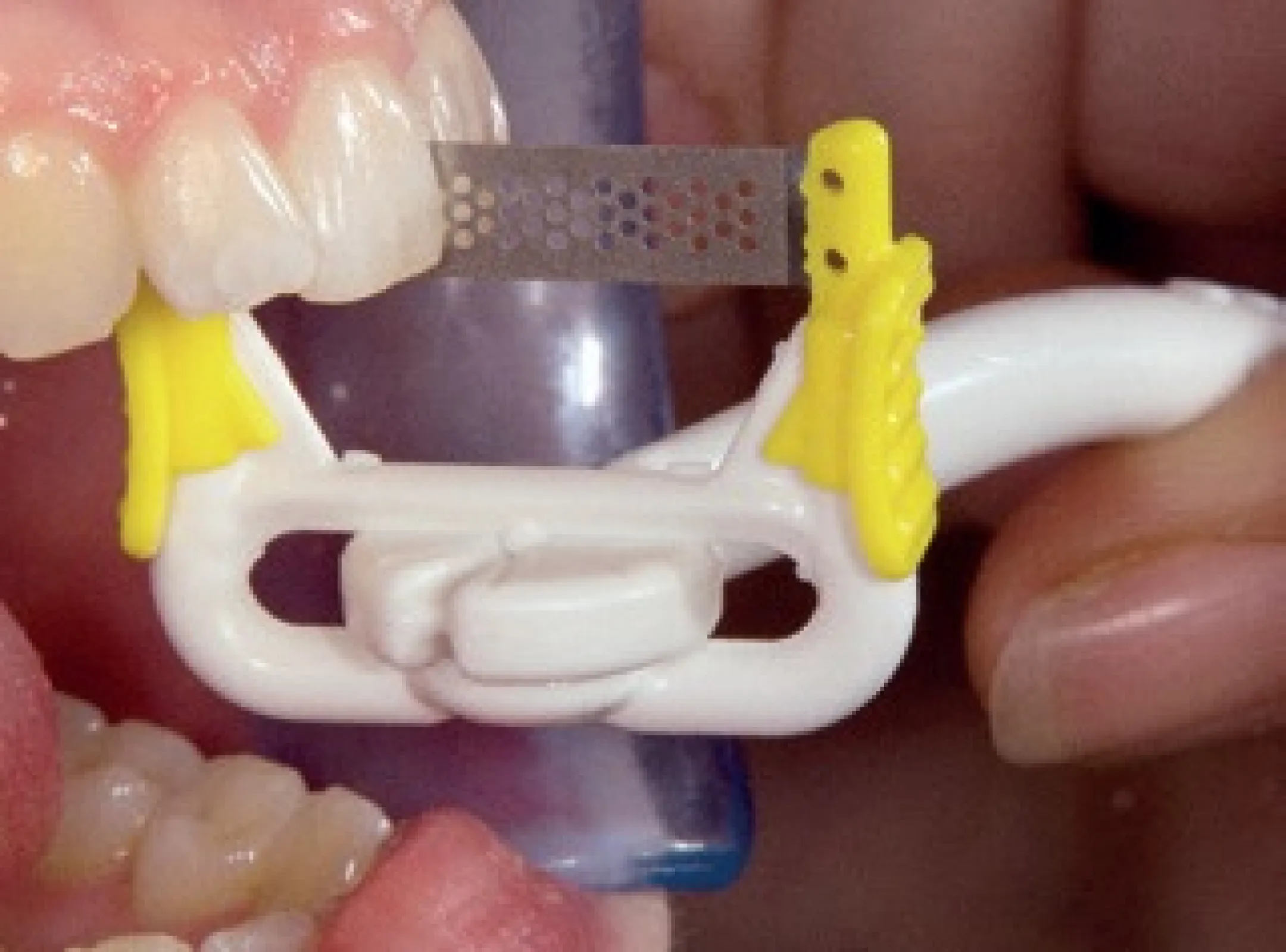 NTI - ProxyStrip
