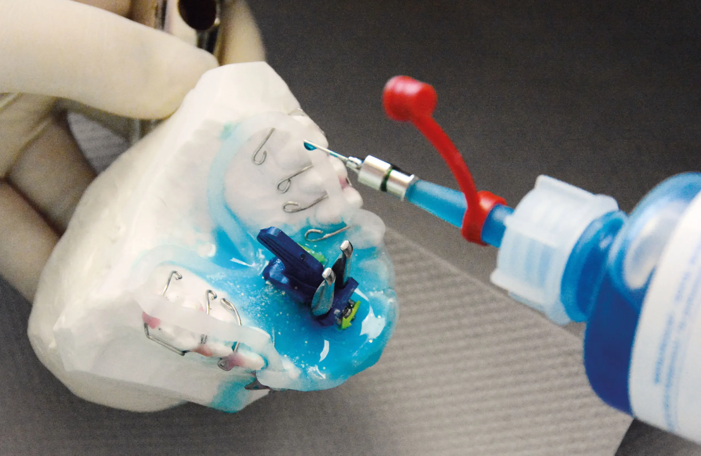 Dentaurum collated numerous tips and tricks from professionals for the practical use of Orthocryl® in a digital guide. Have a look at: https://www.dentaurum.de/lp/eng/orthocryl-guide.aspx