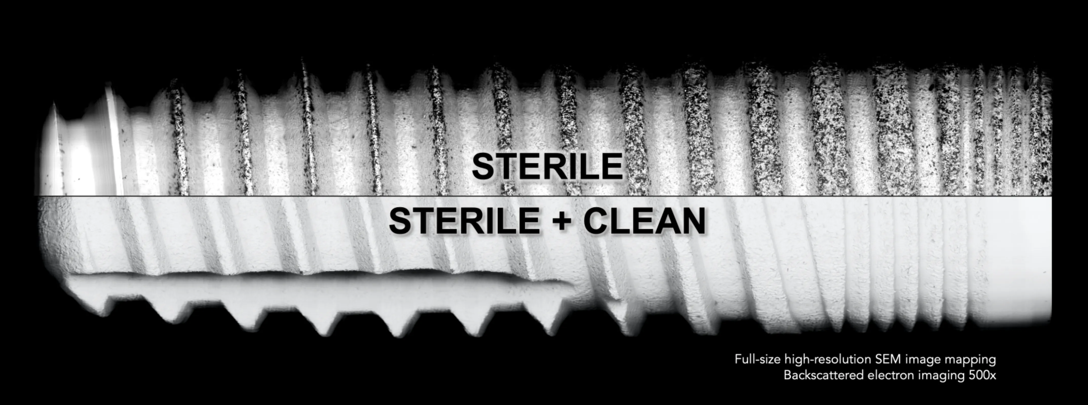 Full-size resolution SEM image mapping of two implants, one sterile packaged, the other sterile-packaged and independently verified as clean.