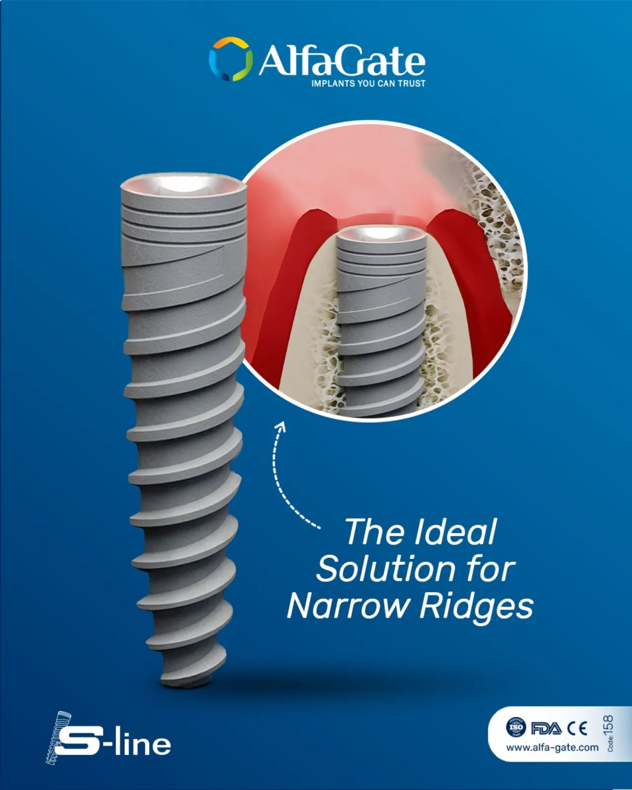 S line Implant