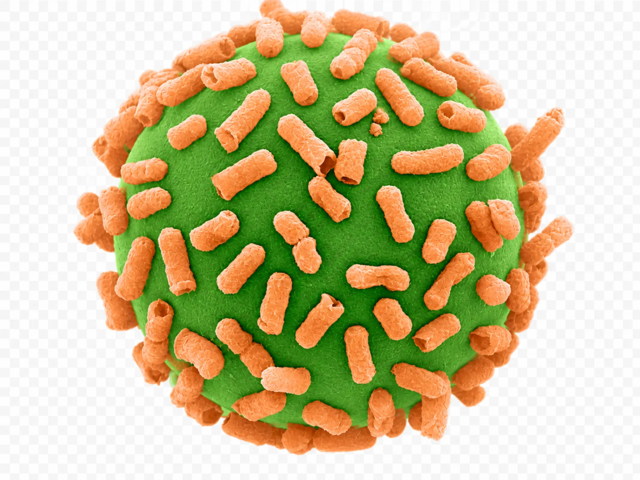 SEM micrograph of a microbead specifically functionalized for E. coli capture after incubation in an E. coli-containing sample.