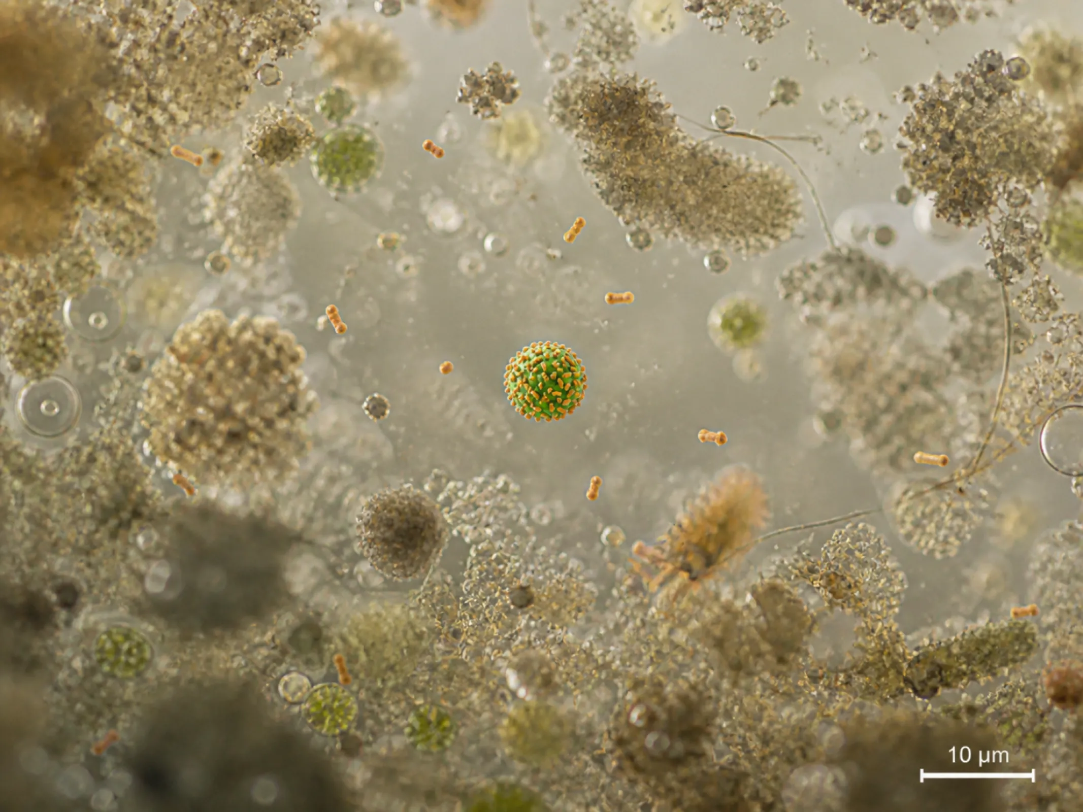 Illustration of a microbead specifically functionalized for E. coli capture in a complex, E. coli-containing medium.
